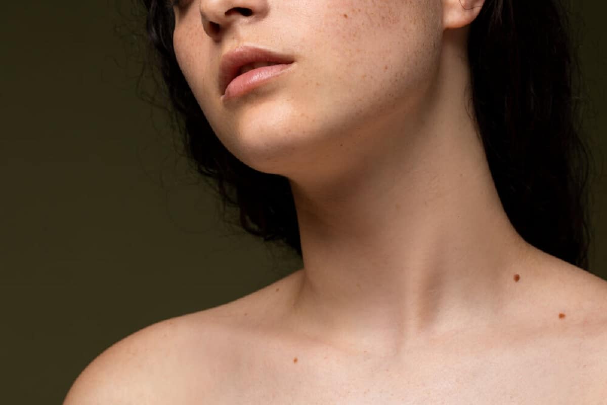 beauty marks and moles featured